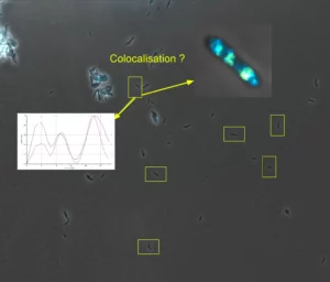 Photo d'une vue de microscope