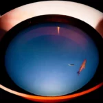 Poissons vus à travers une lentille