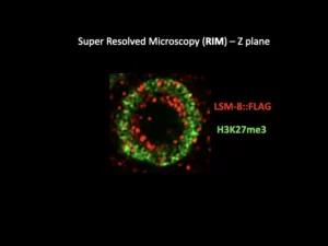 Imagerie super resolved microscopy