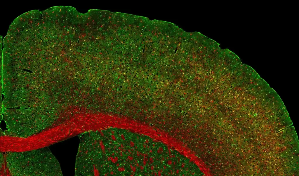 Image illustration Hétérogénéité des astrocytes