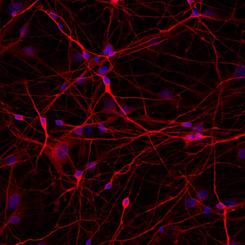 Div40 2D neurons – MAP2 > DAPI