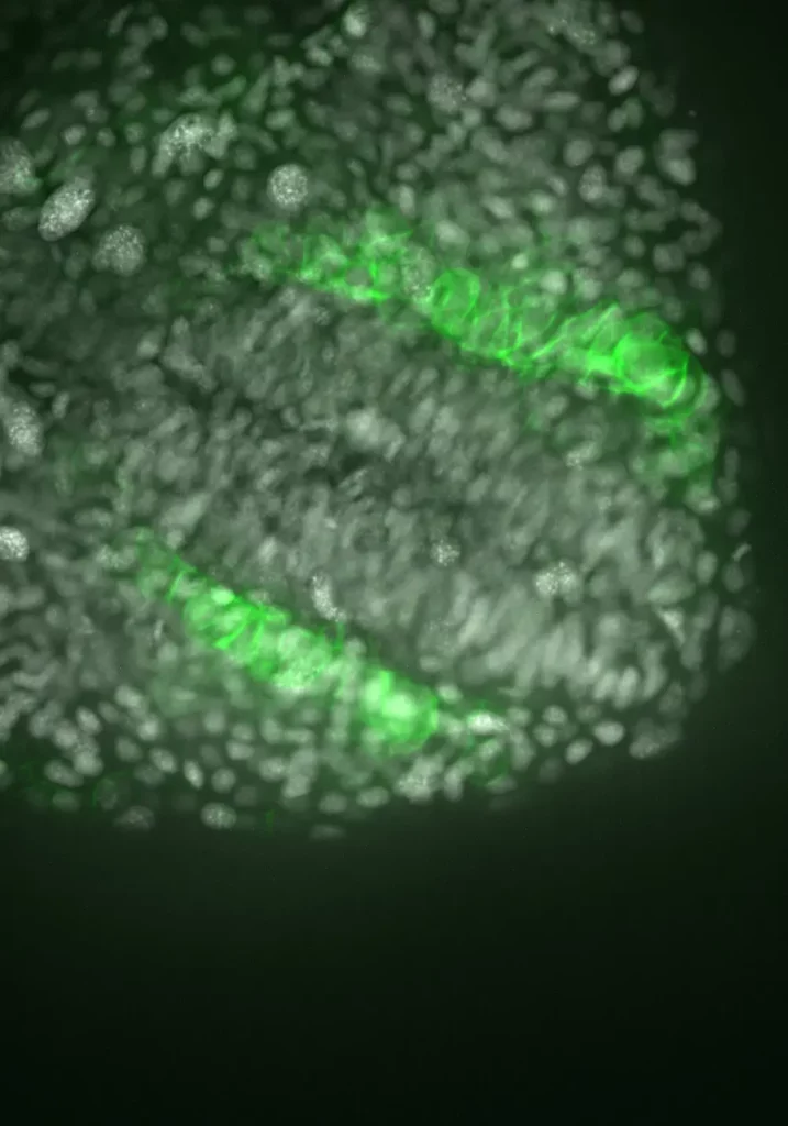 Imagerie spinning disc