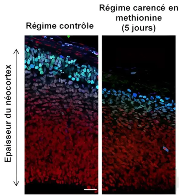 Imagerie néocortex